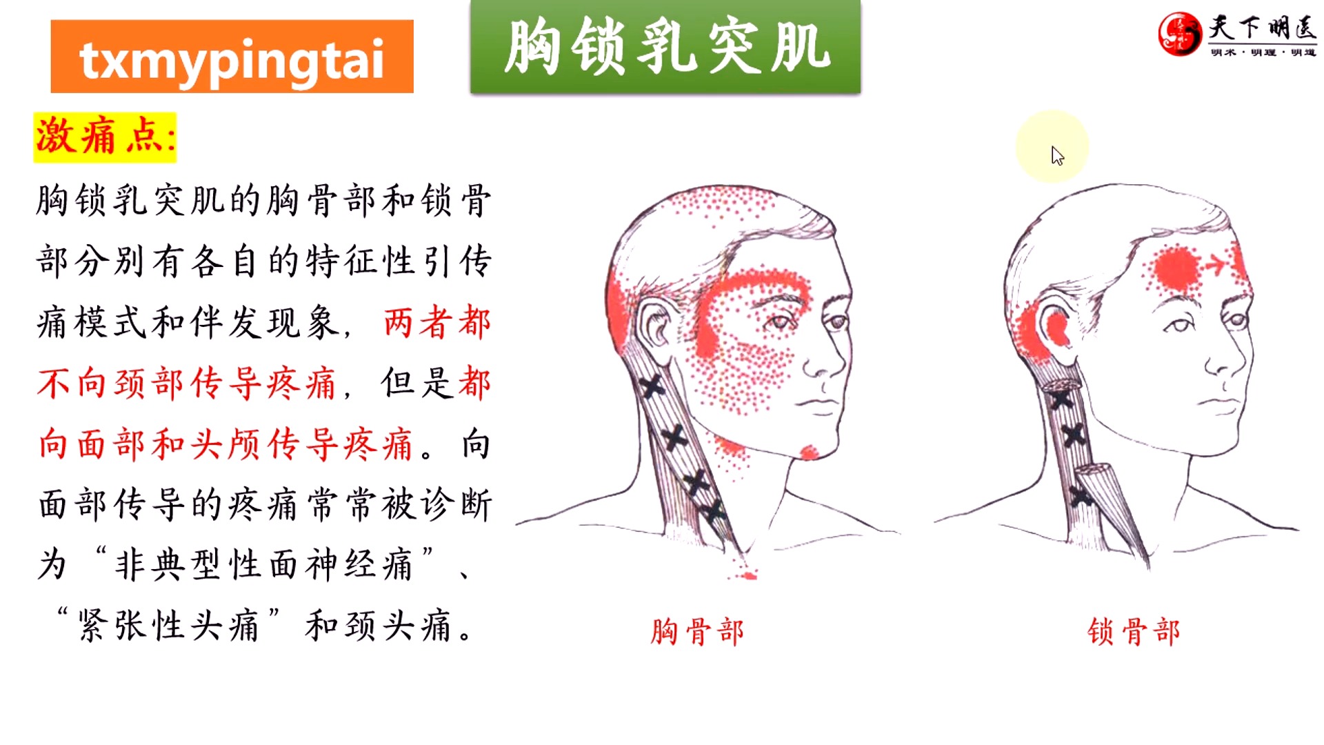 颞肌疼痛图片