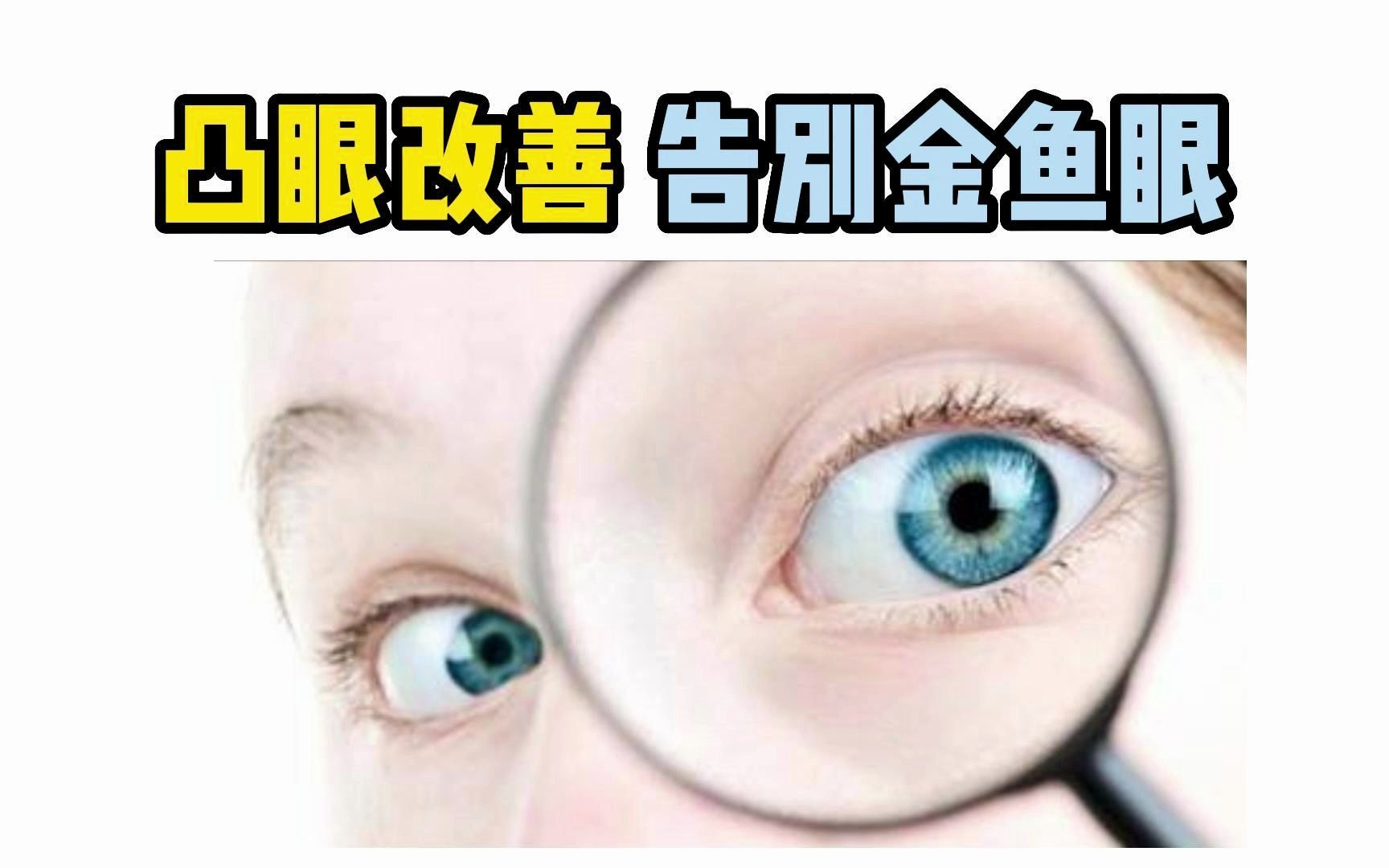 告别金鱼眼,不再因为眼球突出而自卑哔哩哔哩bilibili