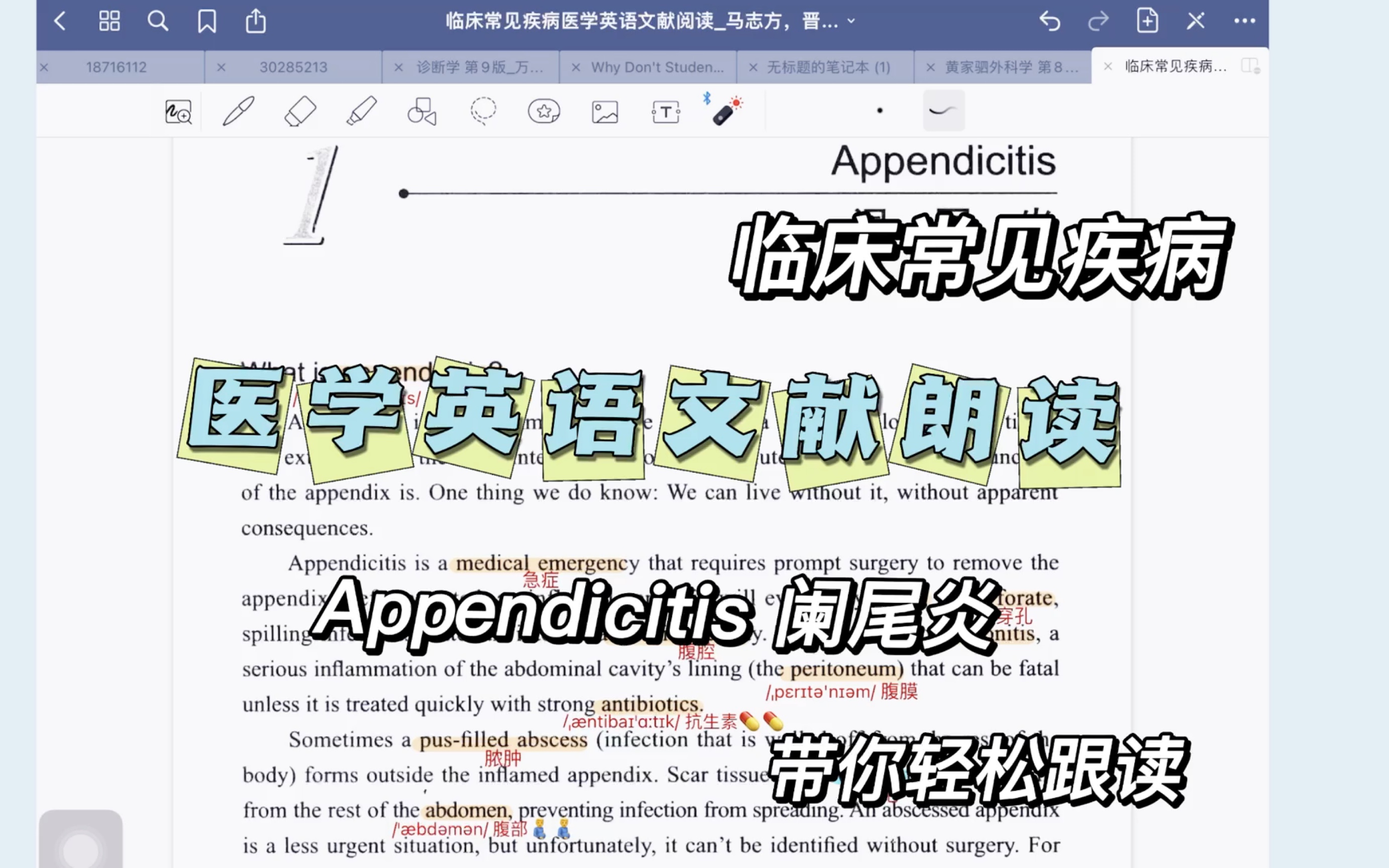医学英语文献朗读|阑尾炎|人声朗读|划词翻译哔哩哔哩bilibili