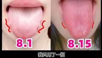 Tải video: 坚持15天，齿痕全消失，舌象大变样!