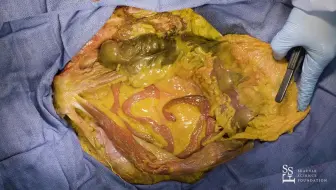 腹腔解剖（P1）