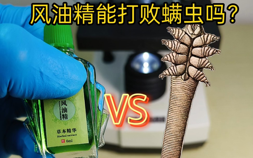 活动  风油精能否辣死螨虫