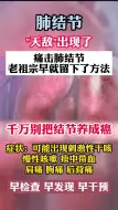 Download Video: 肺结节天敌，预防恶变，有一个好方法