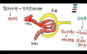 Download Video: 【凹陷性水肿\非凹陷性水肿】肾炎性水肿\肾病性水肿\心源性水肿....