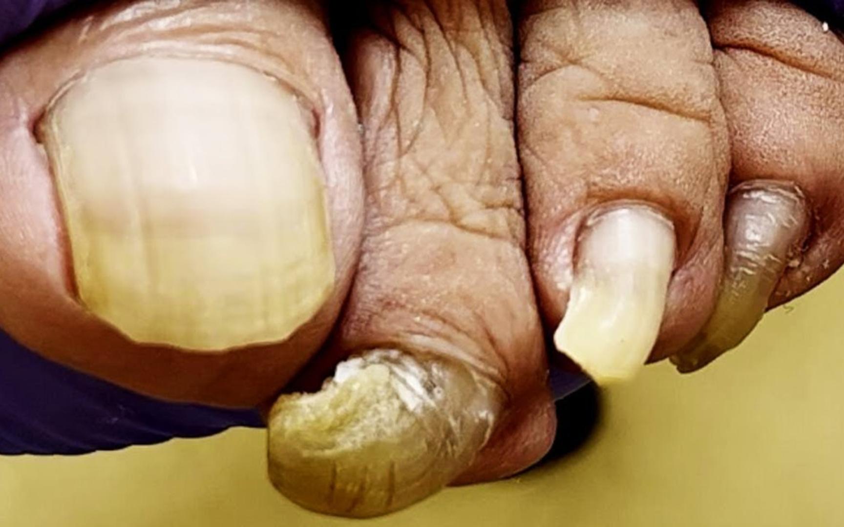 哇~_那个男人的指甲长出了奇怪的形状