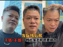 Video herunterladen: 假发应该怎么选，他终于来了