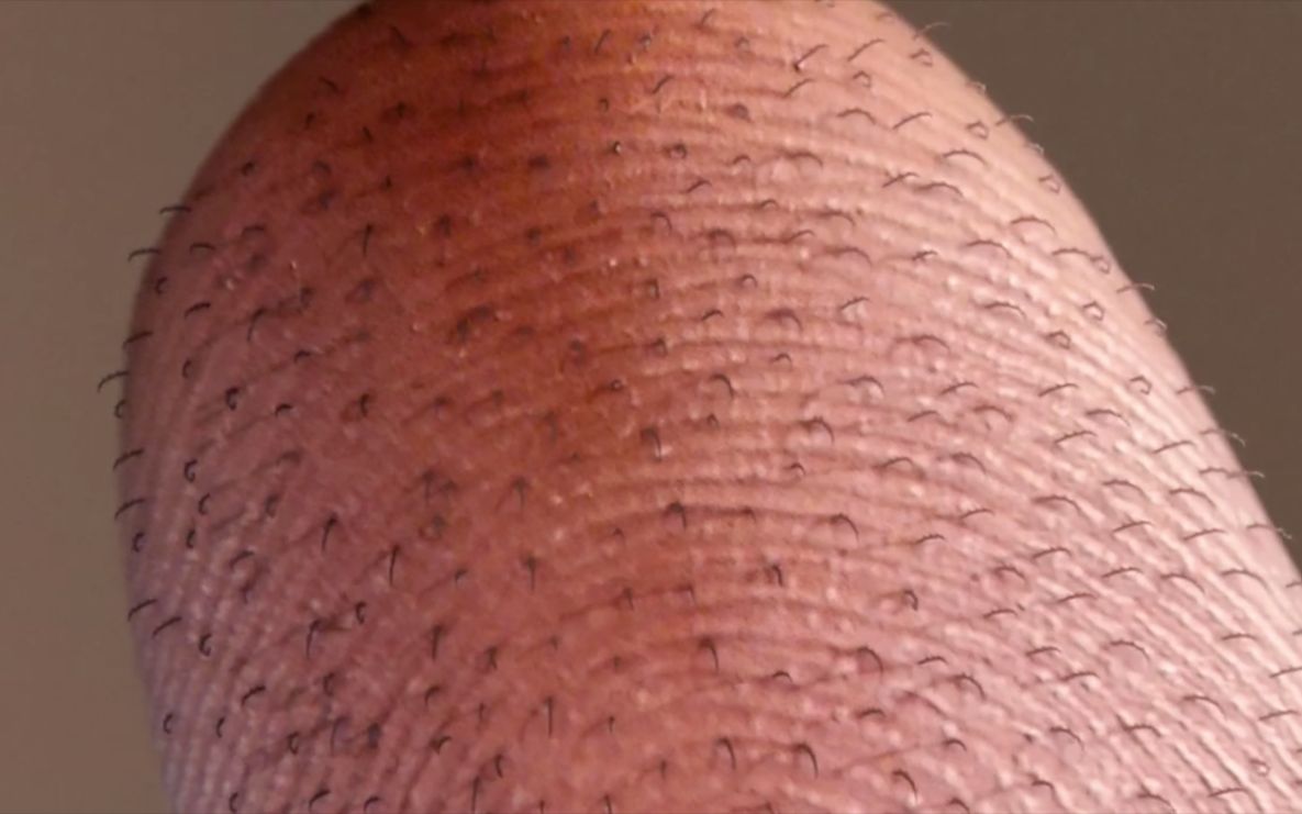 小伙被蜻蜓咬伤,5天后手指肚长毛,新一代超级英雄就此诞生