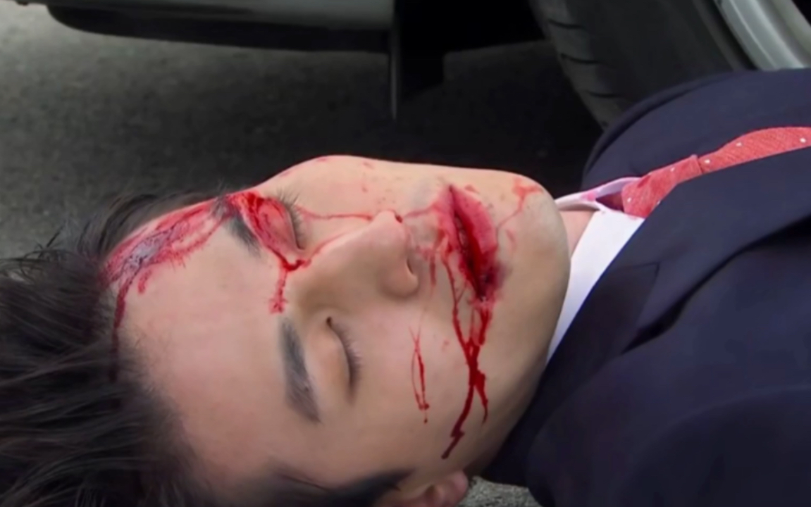 男主角受伤hotleking李栋旭车载皖被虐的好惨