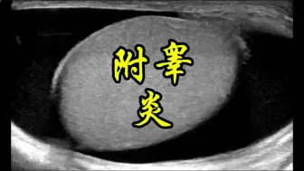 Tải video: 睾丸附睾炎