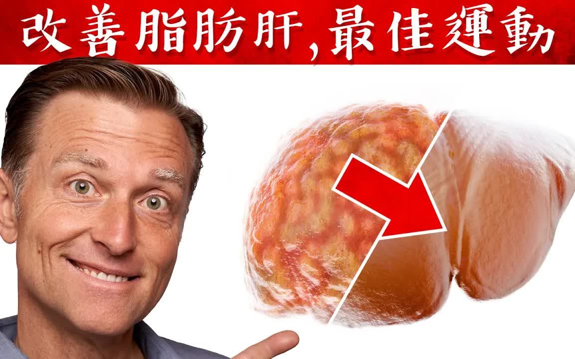 改善脂肪肝的最佳運動,自然療法,柏格醫生 dr berg