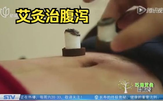 巧用艾灸治腹泻 一起来看《名医话养生》哔哩哔哩bilibili