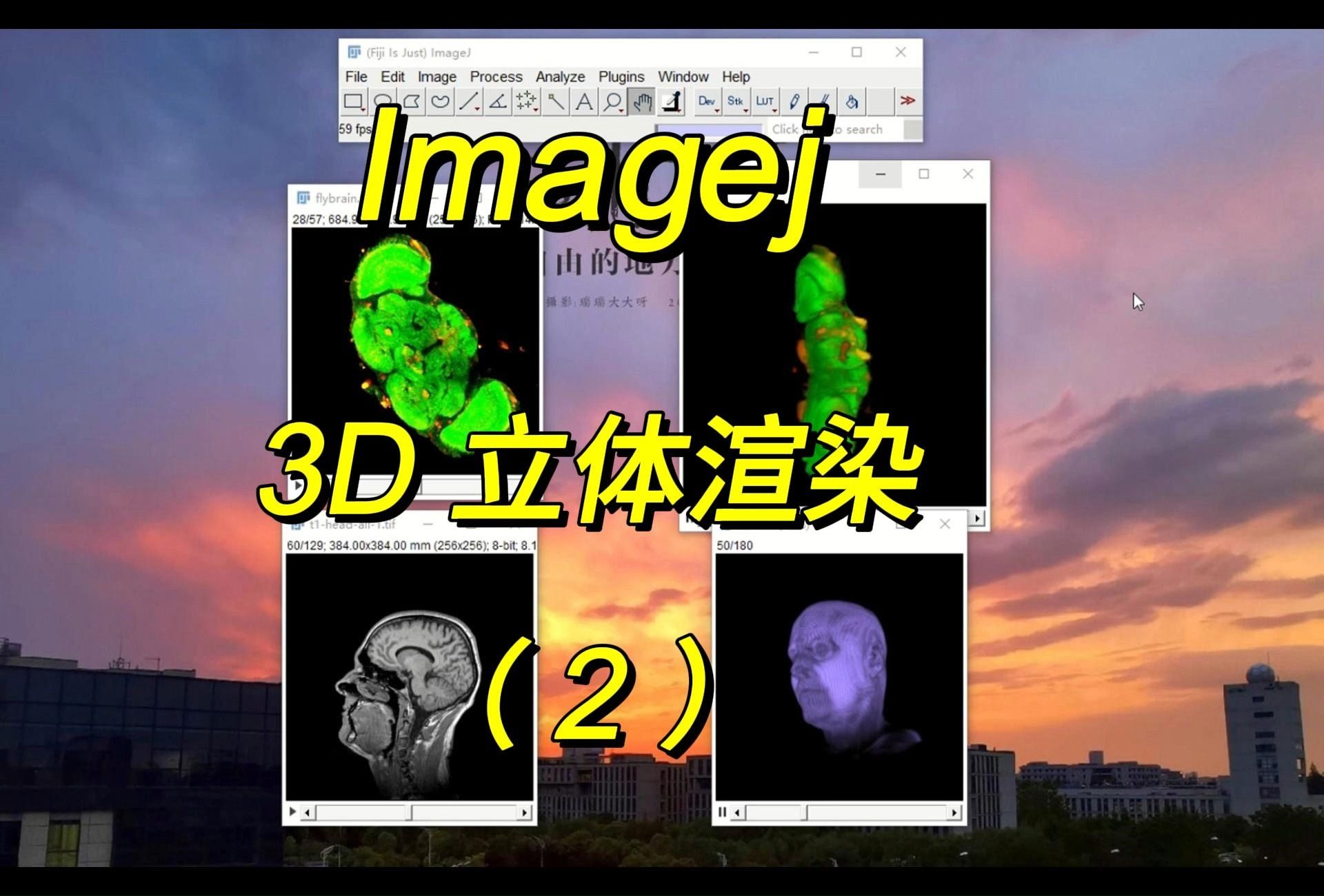 Imagej 3D立体渲染法(2):3D Viewer哔哩哔哩bilibili