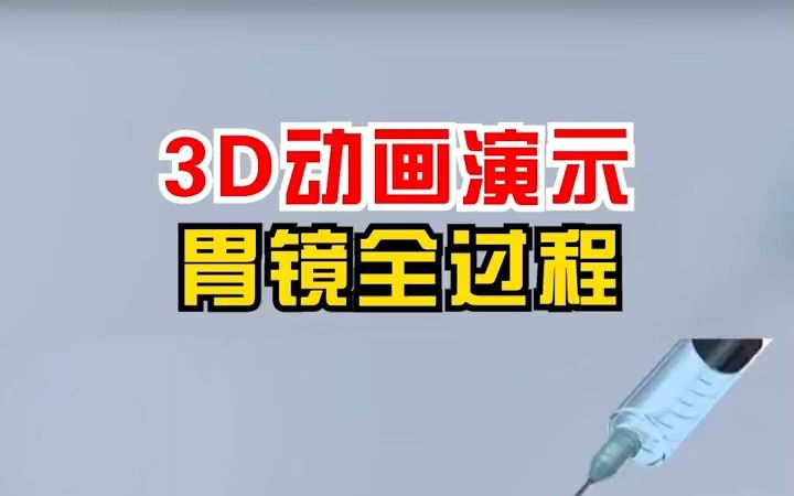 想做胃镜却不敢做?无痛胃镜3D动画演示哔哩哔哩bilibili