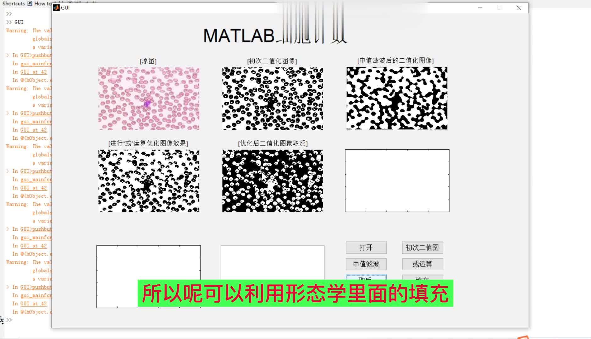 MATLAB细胞计数系统GUI设计.带界面设计哔哩哔哩bilibili