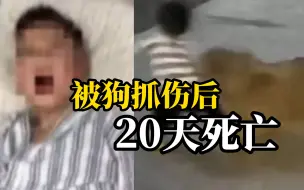 Descargar video: 八岁孩子被狗抓伤家长未做处理，孩子20天后死亡