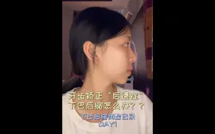 Download Video: 正畸的第四年 我开始调整下巴后缩问题…