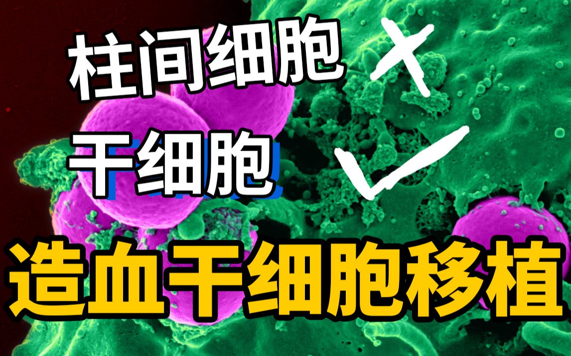 [图]医学博士：年轻人癌症top1！干细胞及白血病造血干细胞移植