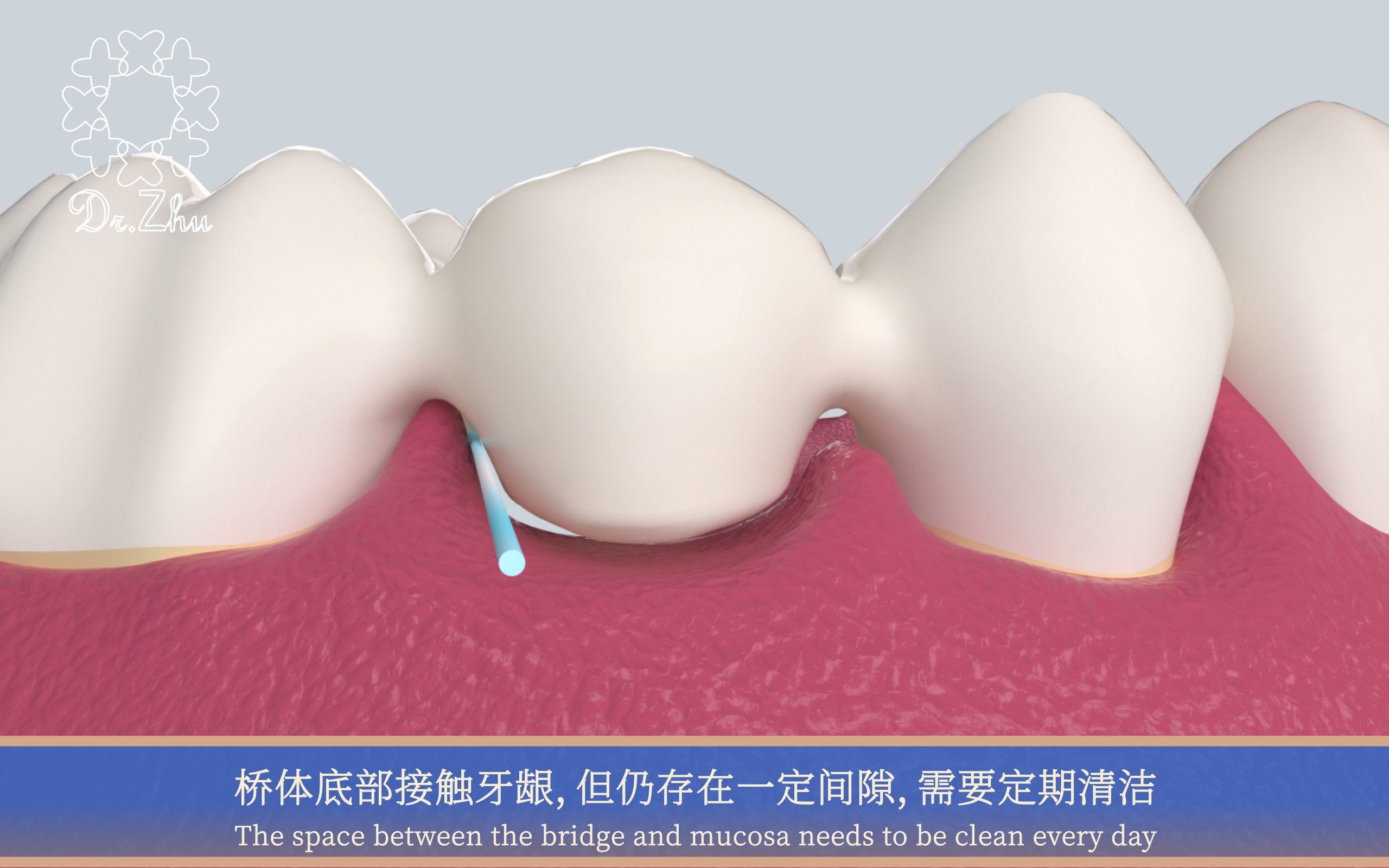 卫生桥桥体龈面图片图片