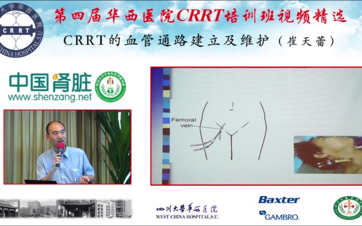 CRRT的血管通路建立及维护(崔天蕾)哔哩哔哩bilibili