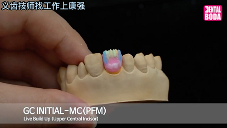 GC瓷粉前牙单冠堆瓷演示by Dental Boda#上瓷#牙匠之家哔哩哔哩bilibili