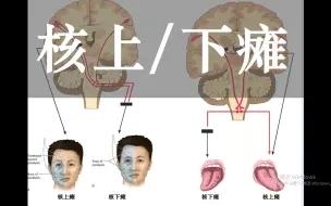 Скачать видео: 【人解三分钟】核上瘫核下瘫，面瘫舌头歪斜：图解锥体系受损的奥秘