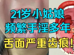 Télécharger la video: 21岁小姑娘，频繁手淫不节制，舌面严重齿痕，使劲糟蹋身体！！