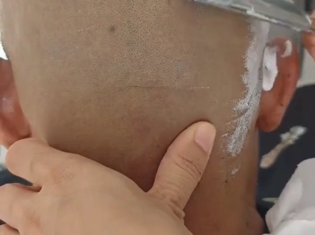 刮个死皮,最后来个跳三刀