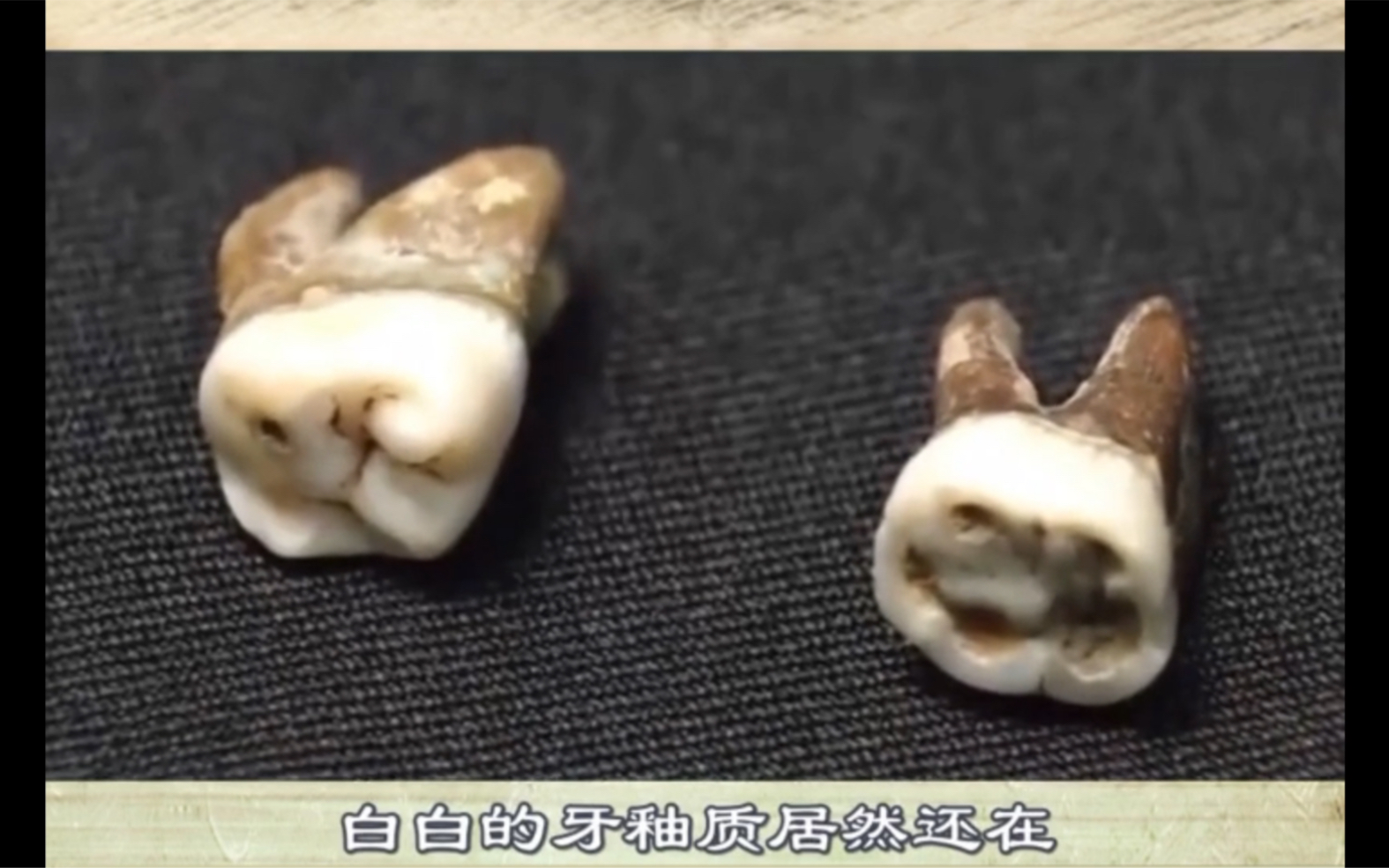 隋炀帝杨广的牙齿