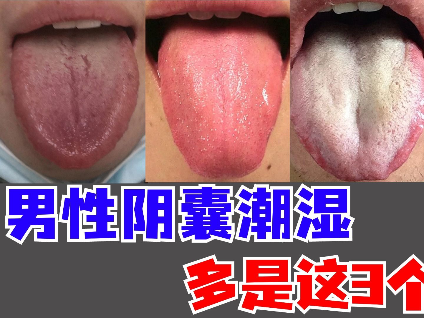 潘大夫舌诊:大腿根湿哒哒的,男性阴囊潮湿,多是这3个因素哔哩哔哩bilibili