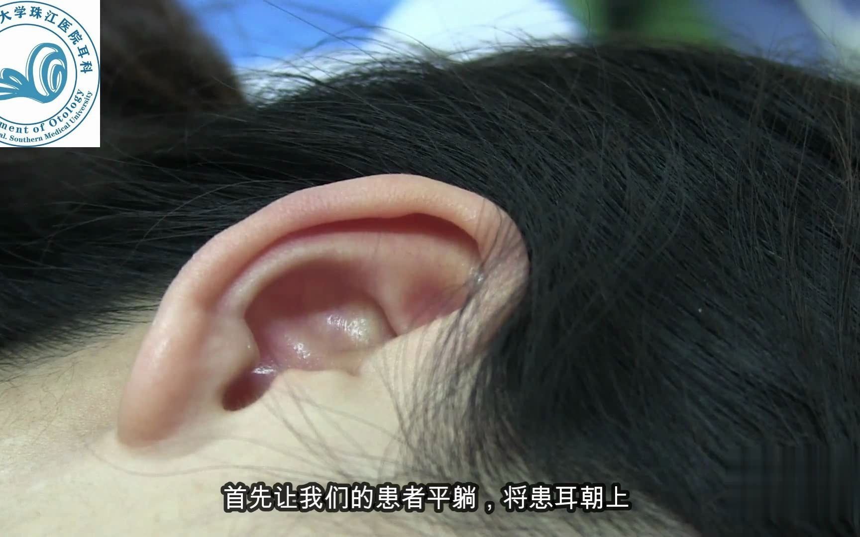 How to use Ear Drop correctly?如何正确使用滴耳液呢?哔哩哔哩bilibili