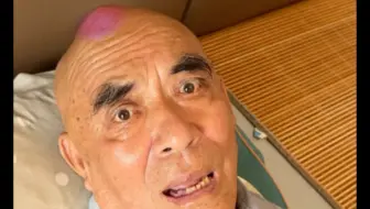 当我骗我妈我给我爷脑袋弹个“大包”