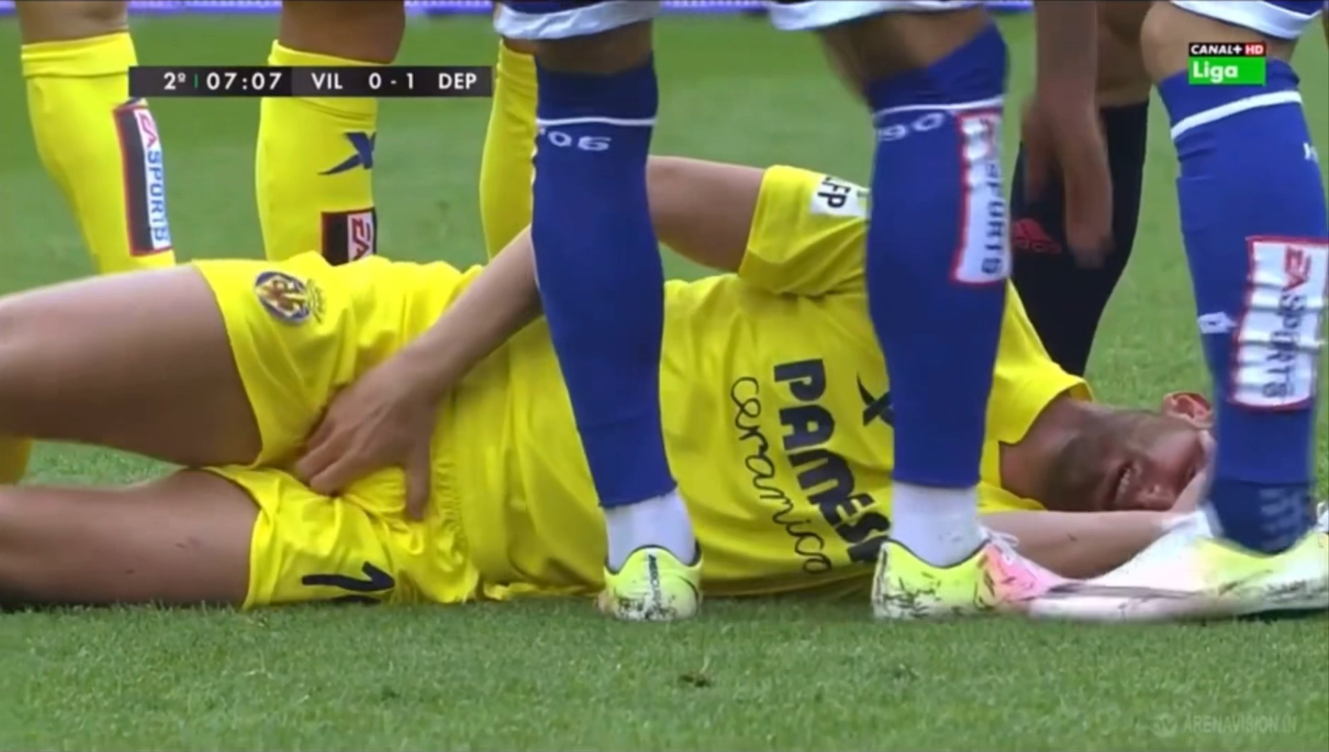 任意球不护裆的后果,黄衣帅哥被足球痛击要害