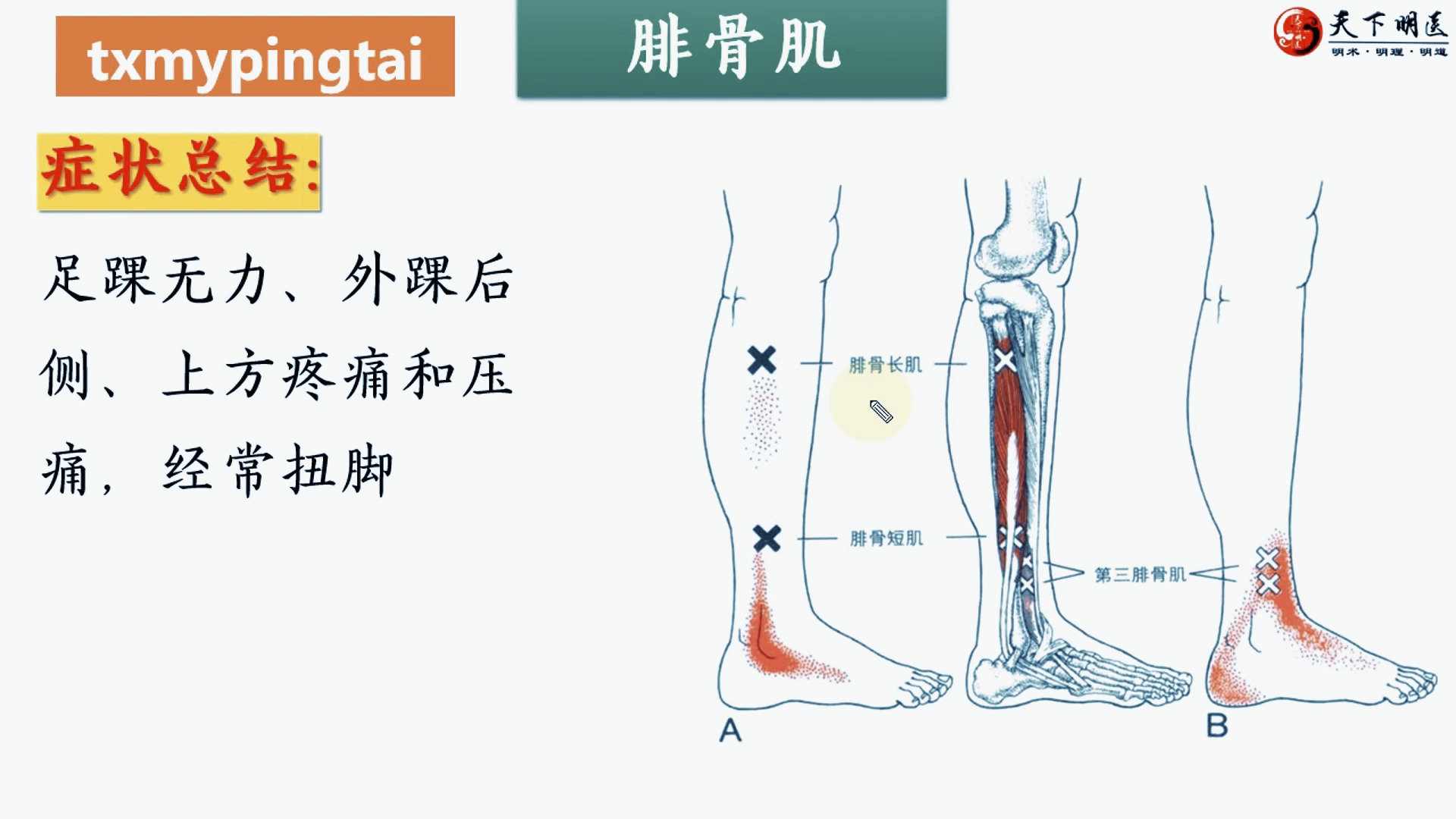 第四腓骨肌图片