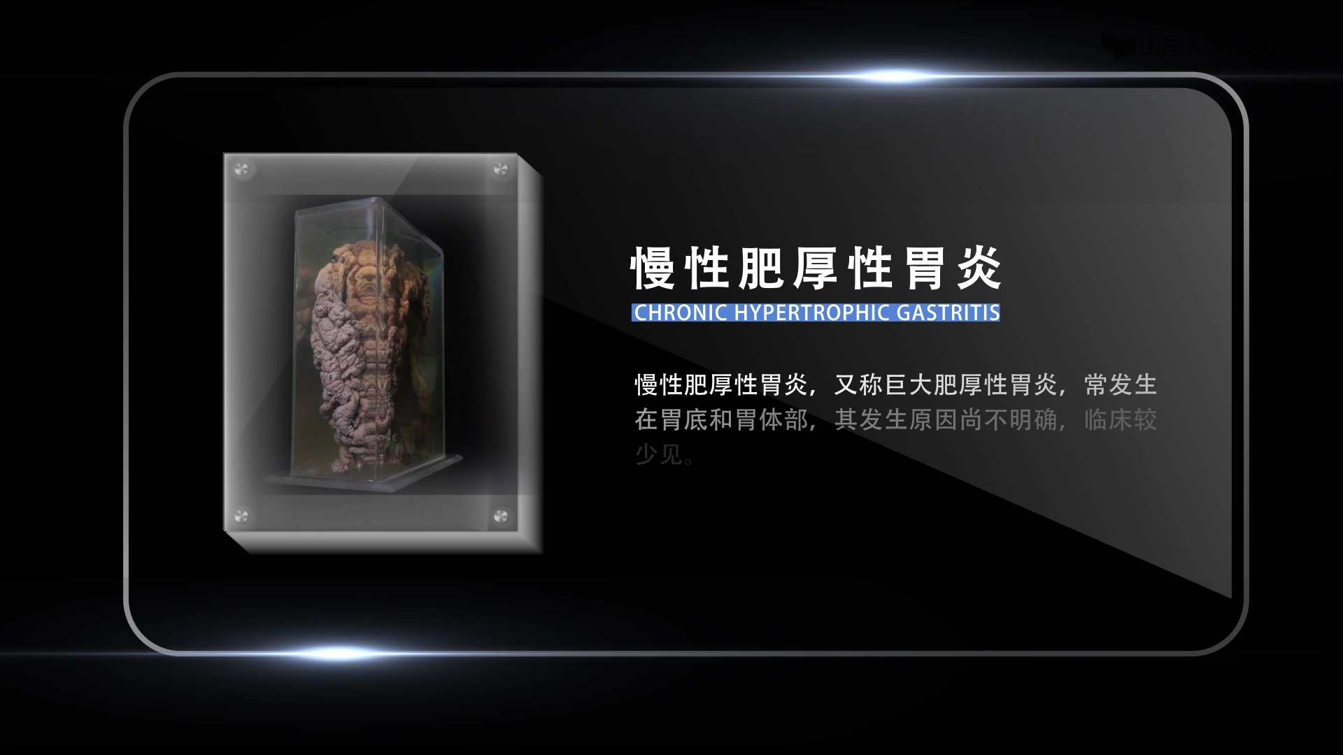 2.3]--病之容颜--慢性肥厚性胃炎