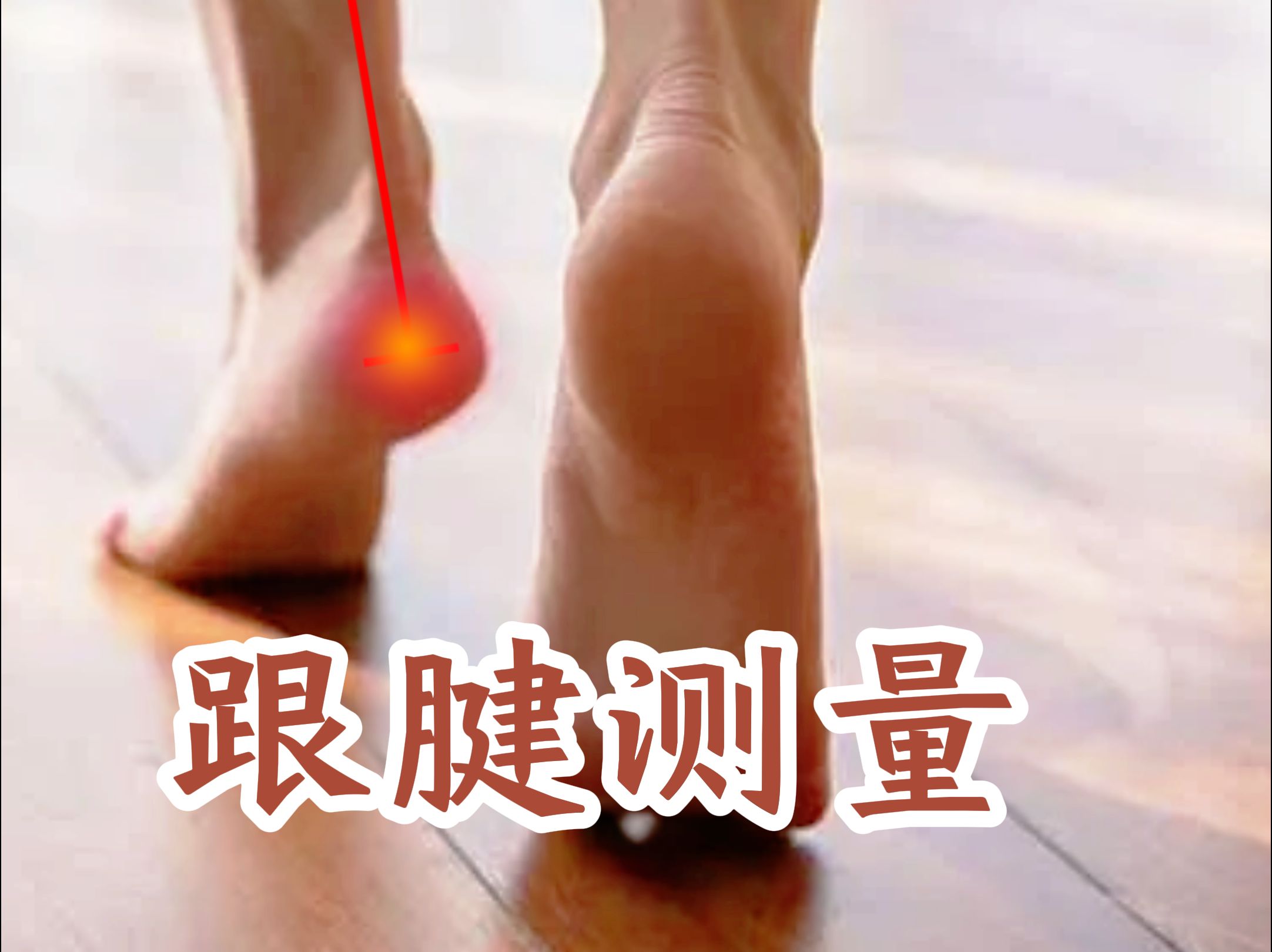 跟腱怎么测量?康复专家支招哔哩哔哩bilibili