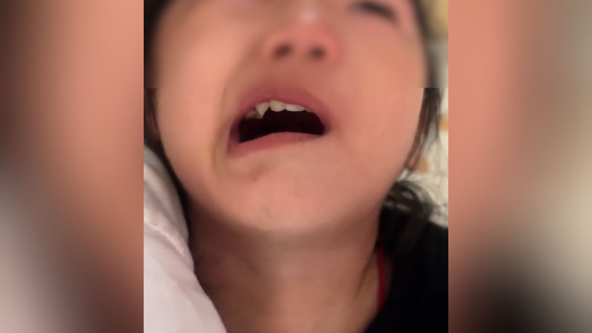 确诊面瘫！13岁女孩出汗后对着空调吹，“感觉对着吹更凉快，结果刺激皮下血管，半边脸麻木僵硬、嘴眼歪斜”。医生：风为百病之长，一定不要直吹