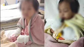 Download Video: 4岁女孩将不锈钢筷插进插板，致9根手指被切，术后哭喊不能再画画