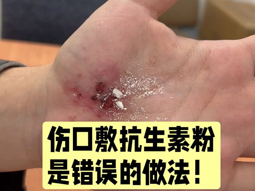 从古至今都做错了,往伤口上撒药粉,反而不利于伤口愈合!哔哩哔哩bilibili