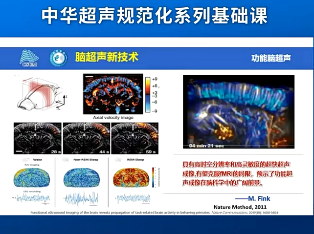 颅脑超声系列中华规范化基础系列课:01颅脑的现状及未来哔哩哔哩bilibili