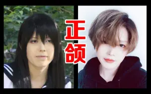 Download Video: 【音少】满满的干货！这些年整形+正颌手术的经历 所有你想看的都在这里了！！！