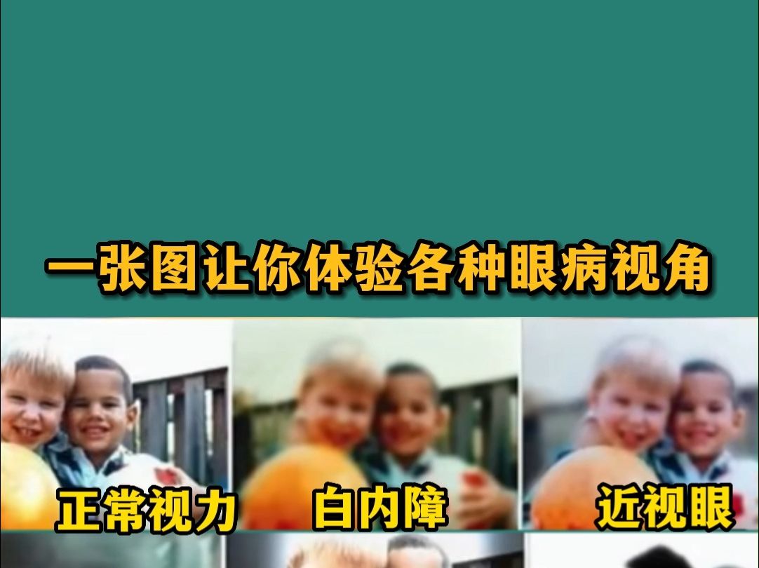 一张图让你体验各种眼病哔哩哔哩bilibili