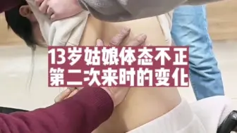 Download Video: 13岁姑娘体态不正，第二次来正骨时的变化