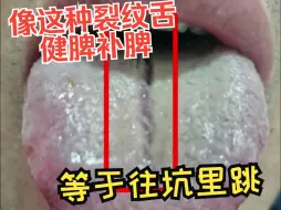 Download Video: 舌诊分析：像这种裂纹舌，健脾补脾，等于往坑里跳