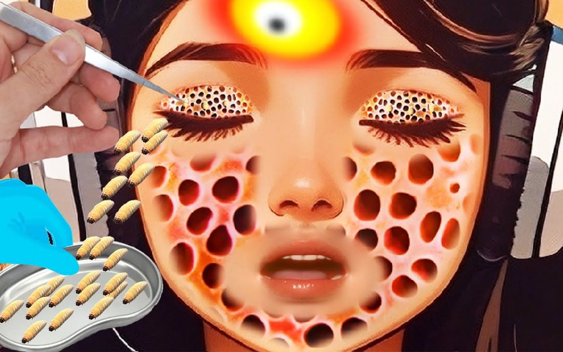 治疗眼部损伤,蛆感染的面部asmr