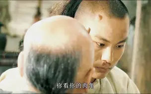 Télécharger la video: 小伙额头长着一个奇怪的犄角，一旦被触动，更是力大无穷无