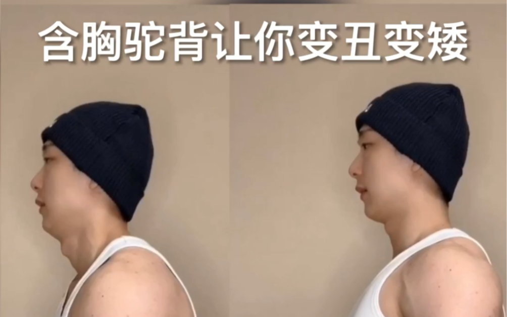 低头玩手机,驼背让你变丑变矮,两招纠正