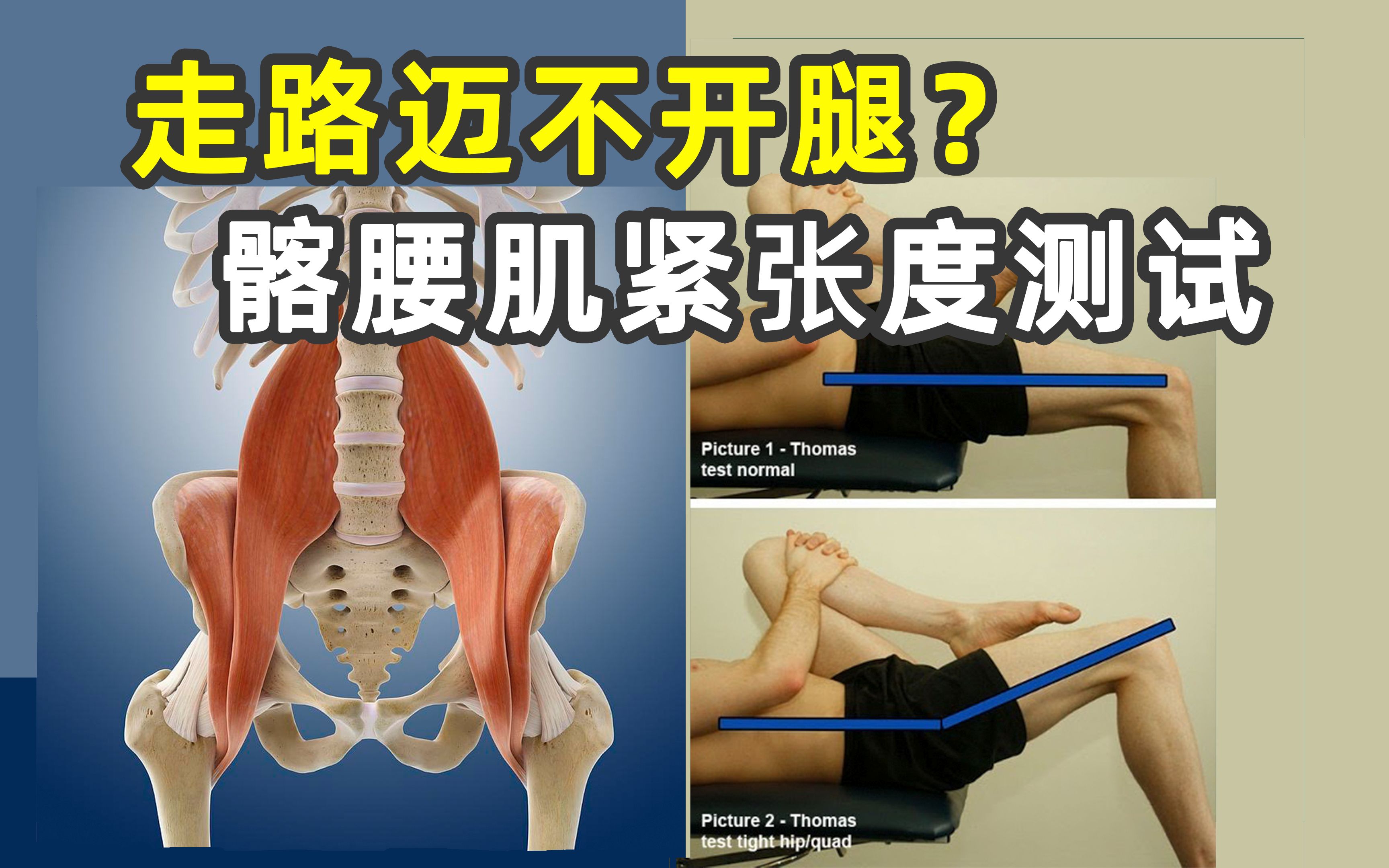 腿疼髋疼?原来是因为髂腰肌紧张!