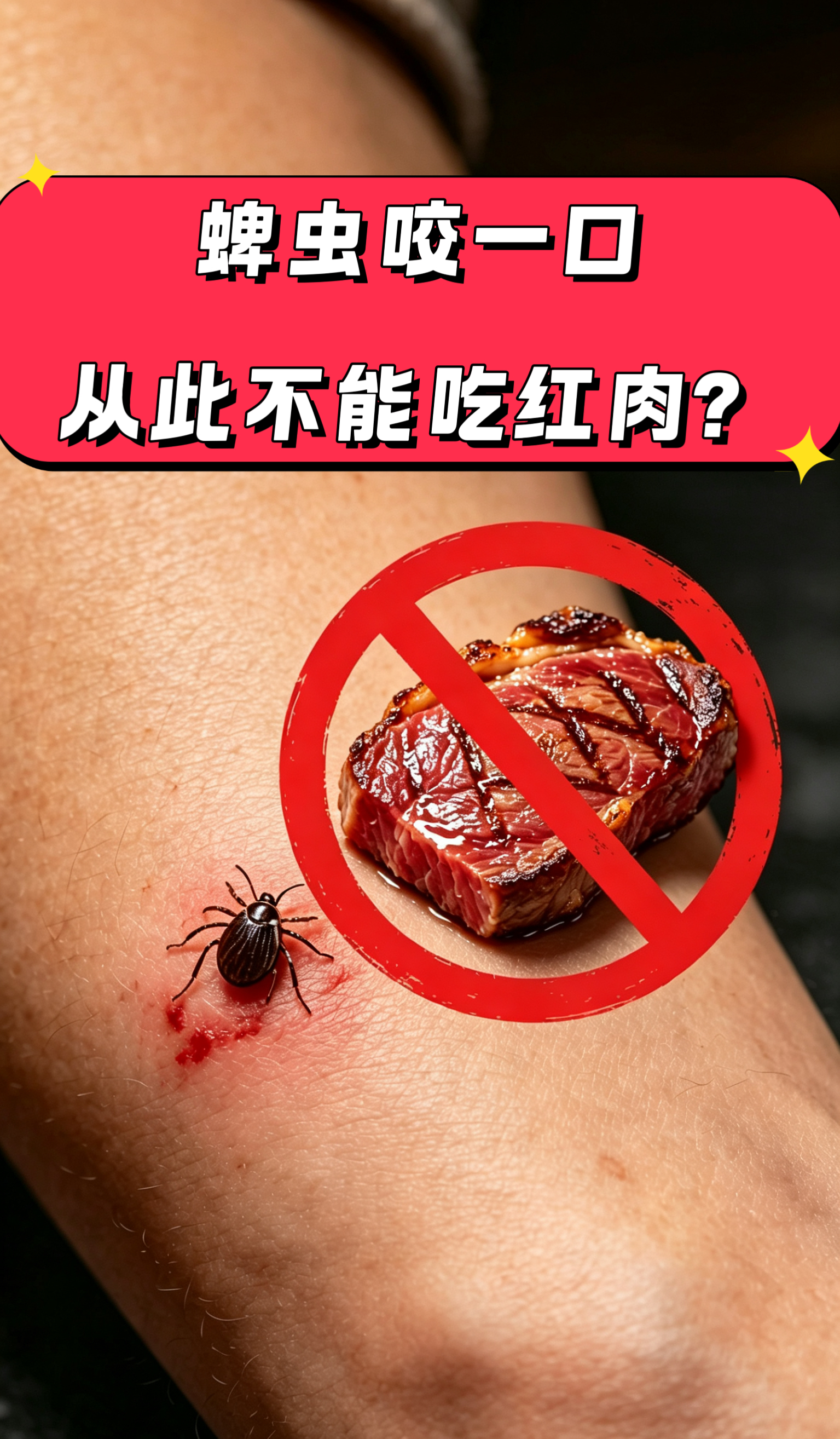蜱虫咬一口可能从此不能吃红肉