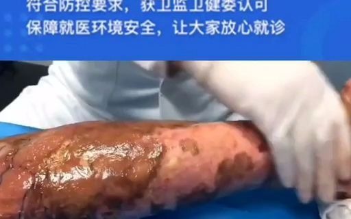 南宁肤康皮肤病医院广西医科大附属人民医院医联体皮肤科网络问诊 看皮肤附近皮肤科全国排名 皮肤医生 皮肤科网上咨询 网上皮肤科专家咨询南宁皮肤病...