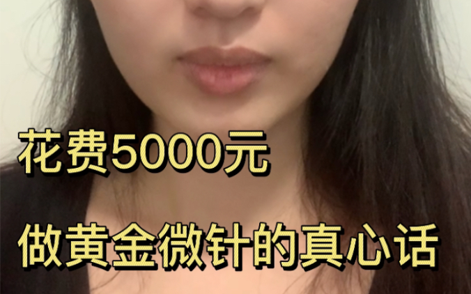 花费5000元做黄金微针的真心话哔哩哔哩bilibili